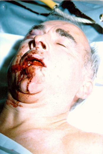 September 16, 1989: Jewish almost killed Robert Faurisson